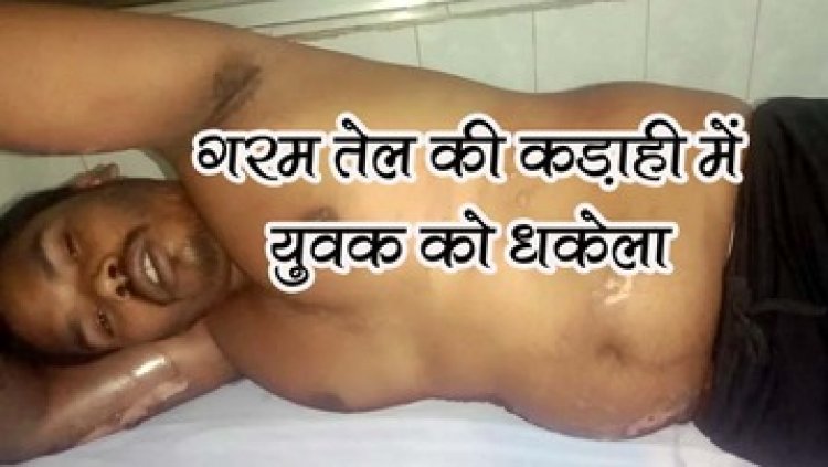 विवाह समारोह के दौरान मामूली विवाद बनी जानलेवा, गरम तेल की कड़ाही में युवक को धकेला, दो के खिलाफ मामला दर्ज