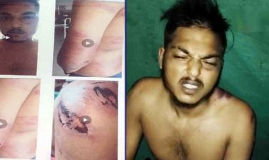 भाजपा पार्षद और गुर्गों की गुंडागर्दी, युवक की बेरहमी से पिटाई, पुलिस पर कार्रवाई नहीं करने का लगा आरोप, एसपी से लगाईं इंसाफ की गुहार