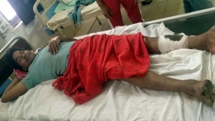 गरियाबंद के जंगल में भालू का आतंक, तेंदूपत्ता तोड़ने गए दो ग्रामीणों पर जानलेवा हमला, ग्रामीण जख्मी, इलाके में दहशत का माहौल