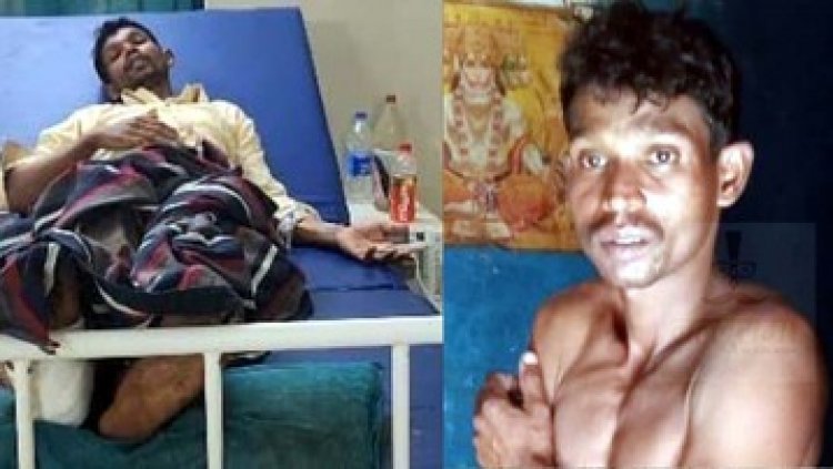 तेंदूपत्ता तोड़ने गए युवक पर मादा भालू ने किया पैर पर हमला, पेड़ पर चढ़कर बचाई जान, अस्पताल में इलाज जारी, 3 महीने में तीसरी घटना से हड़कंप