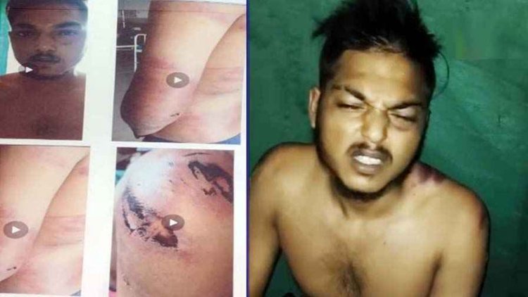 भाजपा पार्षद और गुर्गों की गुंडागर्दी, युवक की बेरहमी से पिटाई, पुलिस पर कार्रवाई नहीं करने का लगा आरोप, एसपी से लगाईं इंसाफ की गुहार