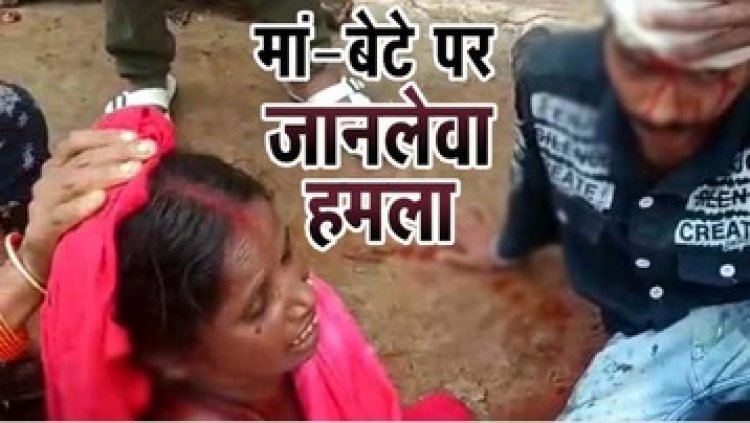मां-बेटे पर लाठी से हमला: छेना थापने के लिए भूसे को लेकर हुआ विवाद दोनो गंभीर रुप से हुए घायल, मामूली विवाद बना हिंसक, सिम्स रेफर