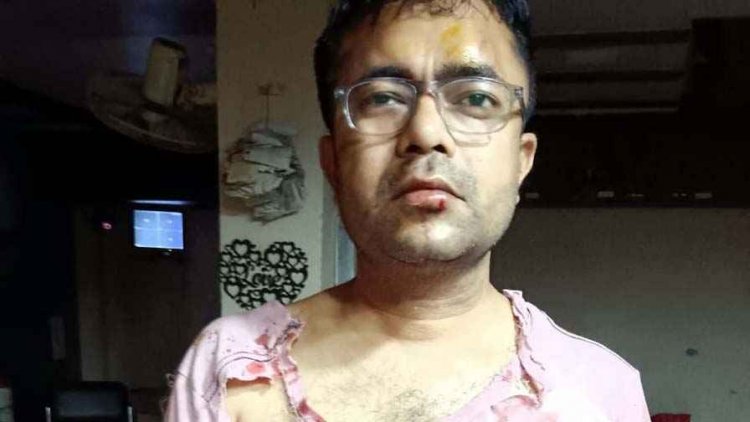 घर जा रहे व्यापारी का रास्ता रोककर तलवार बेसबॉल डंडे से आधा दर्जन से ज्यादा बदमाशों ने किया हमला, हमलावर फरार