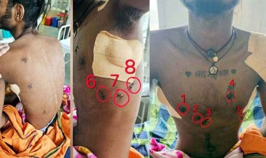 17 बार चाकू से वार, फटा फेफड़ा-कटी आंत, मौत के दरवाजे से लौटा 19 साल का युवक, डॉक्टरों ने लिखी जिंदगी की नई कहानी