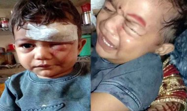 मवेशियों की लड़ाई से मचा हड़कंप, गणेश-पंडाल के पास खड़े बच्चे समेत 4 लोग घायल, मासूम का दांत टूटा, आंख के पास आई चोट