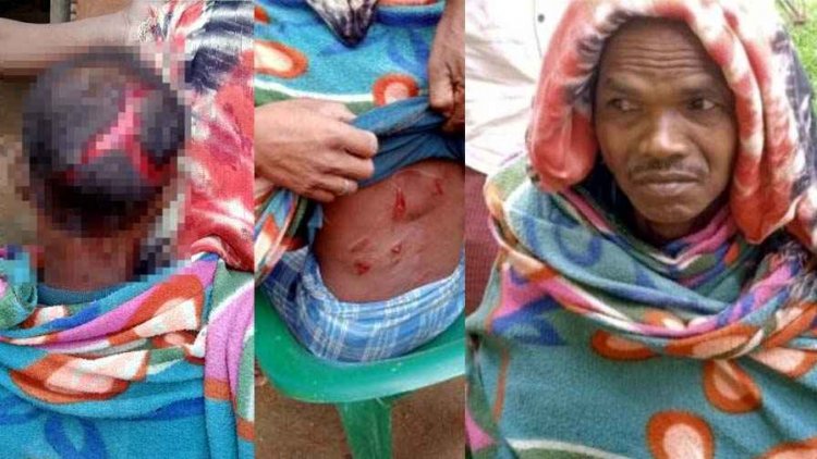 गरियाबंद में भालू का खौफ, 48 वर्षीय धनेश पर हमला, लहूलुहान हालत में अस्पताल में भर्ती, ग्रामीण कर रहे सुरक्षा की मांग