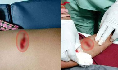 रायपुर में शराब के लिए पैसे न देने पर नाबालिग ने किया मां-बेटे पर चाकू से हमला, दोनों गंभीर रूप से घायल, आरोपी फरार, तलाश जारी