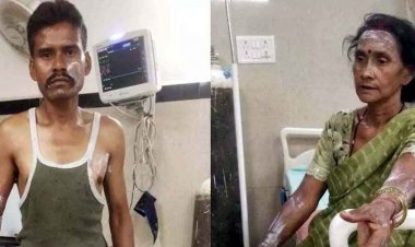 देर रात मंदिर खोलने को लेकर विवाद, आरोपी ने मां-बेटे पर फेंका उबलता तेल, दोनों गंभीर रूप से झुलसे, इलाज जारी, इलाके में तनाव का माहौल