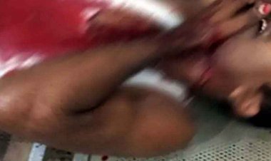 पड़ोसी ने टेलर का गला आरी से रेता, जान बचाकर दोस्त मौके से फरार, ग्रामीणों ने खून से लथपथ हालत में पहुंचाया अस्पताल, आरोपी गिरफ्तार