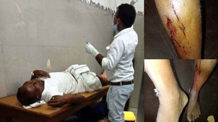 तालाब में नहाने गए चार लोगों पर लोमड़ी ने किया हमला, एक की हालत नाजुक, अस्पताल में भर्ती, ग्रामीणों में दहशत का माहौल