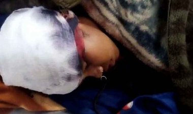 घर में घुसकर 16 साल की लड़की पर टंगिया से जानलेवा हमला, नाजुक हालत में जिला अस्पताल रेफर, मचा हड़कंप, आरोपी की तलाश जारी