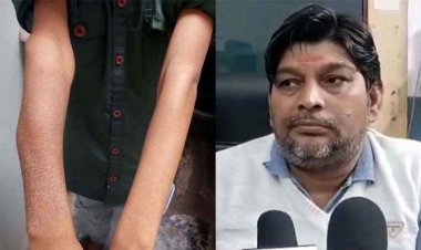 डॉक्टर ने Whatsapp पर एक्स-रे दिखाकर लिया ज्ञान, 9 वर्षीय बच्चे का प्लास्टर करने में कर दी लापरवाही, मासूम सूजन और दर्द से बेहाल