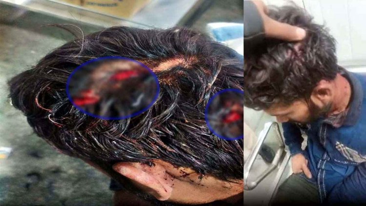 गणतंत्र दिवस के दिन रायपुर स्टेशन पर दिनदहाड़े लूट, ट्रेन का इंतजार कर रहे युवक पर चाकू से हमला, सर में गंभीर चोटें, इलाज जारी