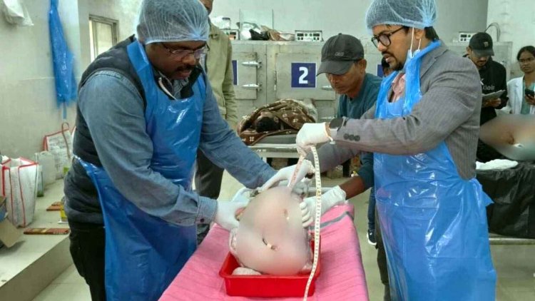 पेट दर्द-बेहोशी के बाद मौत, पोस्टमॉर्टम में चौंकाने वाला खुलासा, महिला के पेट से निकला 11 किलो का ट्यूमर, डॉक्टर भी रह गए दंग, दी चेतावनी