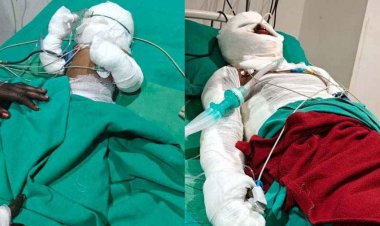 कार्बन प्लांट हादसे में 9 महीने की मासूम बच्ची की हुई मौत, घायल मजदूरों पर FIR वापस लेने का दबाव, परिजन कर रहे उचित मुआवजा की मांग