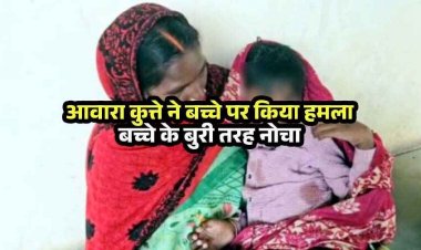 आवारा कुत्तों का बढ़ रहा आतंक, स्कूल जा रहे मासूम को कुत्ते ने बुरी तरह नोचा, नाजुक हालत में अस्पताल में भर्ती, इलाके में दहशत का माहौल