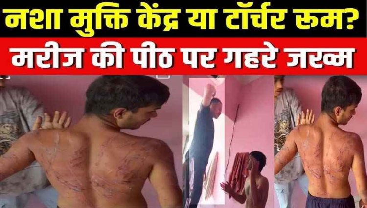 नशा मुक्ति केंद्र में भर्ती आदिवासी युवक की पाइप से चमड़ी उखड़ते तक पिटाई, पीठ-गर्दन पर गहरे जख्म, बिगड़ी मानसिक हालत, वीडियो वायरल, FIR दर्ज