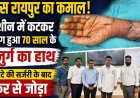 एम्स रायपुर का कमाल, मशीन में कटकर बुजुर्ग का हाथ अलग, 8 घंटे की सर्जरी के बाद फिर से जोड़ा, समय पर सही इलाज की अहमियत उजागर