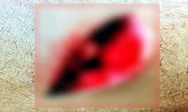 राजधानी में फिर चला चाक़ू, श्यामनगर में मोबाइल शॉप संचालक पर सरेराह चाकूबाजी, कारोबारी घायल, हालत नाजुक, आरोपी फरार, तलाश में जुटी पुलिस