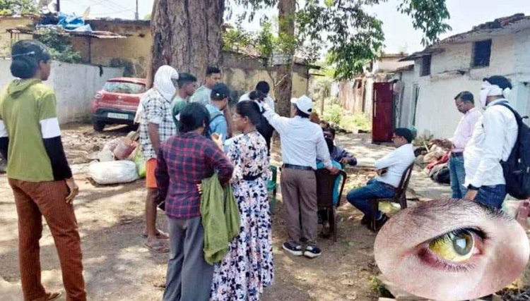 बढ़ा पीलिया का खतरा, शहर में 37 मरीज मिलने से मचा हड़कंप, विभाग ने जारी किया अलर्ट, घर-घर हो रहा सर्वे और सैंपलिंग, पानी सप्लाई पर फोकस