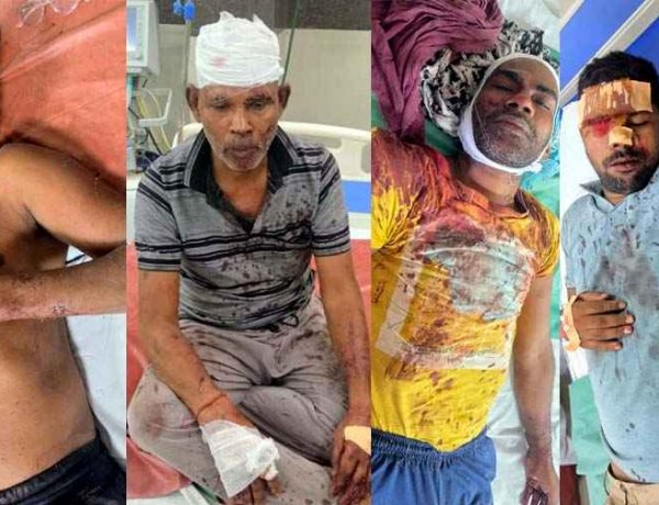 जमीन विवाद में भाइयों के बीच खूनी संघर्ष, बंटवारे को लेकर विवाद, लाठी-डंडे और कुल्हाड़ी से हमला, छह लोग घायल, काउंटर केस दर्ज, जांच में जुटी पुलिस
