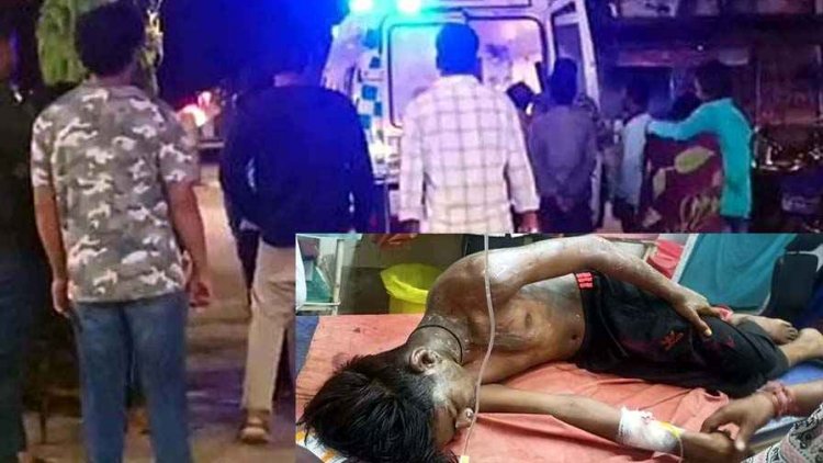धमतरी में ‘एसिड अटैक’ से दहशत, मामूली विवाद ने लिया खौफनाक मोड़, तेजाब फेंककर जिंदा जलाने की कोशिश, नाबालिग गंभीर, आरोपी फरार