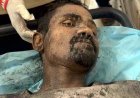 खदान में कर्मचारी की संदिग्ध मौत, कर्मचारियों में नाराजगी, वायरल वीडियो से उठे कई सवाल, चाचाओं का बाजार गर्म, उठ रही पारदर्शी जांच की मांग
