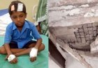 माना के राय पब्लिक स्कूल में हादसा, क्लास में छात्र के ऊपर गिरा पंखा, इधर चलती क्लास में सरकारी स्कूल की छत का हिस्सा गिरा, 3 बच्चे गंभीर रूप से घायल