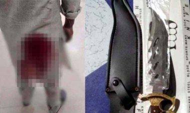 राजधानी में नहीं थम रही चाकूबाजी, पुराने विवाद को लेकर युवक पर चाकू से हमला, मारपीट में दो घायल, पुलिस की हिरासत में आरोपी, पूछताछ जारी