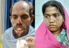 कुत्ते ने ग्रामीणों पर किया हमला, हमले से दो ग्रामीण घायल, हालत नाजुक, गरियाबंद जिला अस्पताल रेफर, गांव में अफरा-तफरी का माहौल