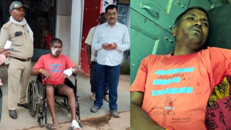 खेत में खाद छिड़कने गए किसान पर बाघ का हमला!, लोहे के घमेला से बचाई जान, हाथ-पैर और चेहरे पर पंजों के निशान, छह गांवों में सतर्क रहने की मुनादी