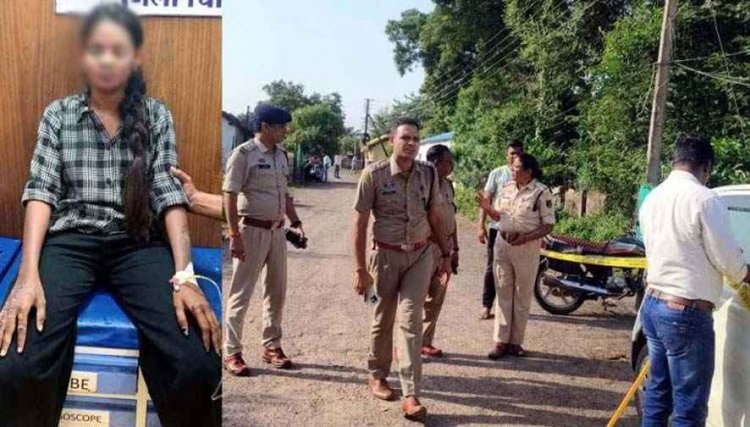 पुलिसकर्मी की बेटी पर एसिड अटैक: लाइब्रेरी से घर लौटते वक्त हमला. शरीर का दाहिना हिस्सा और आंख-चेहरा झुलसा, रायपुर रेफर, हिरासत में 2 संदेही